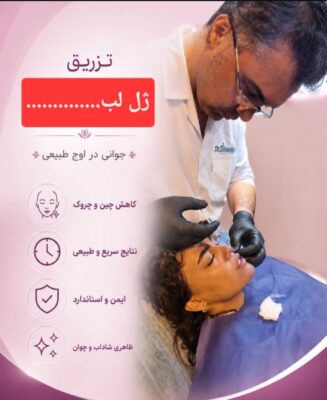 ژل لب